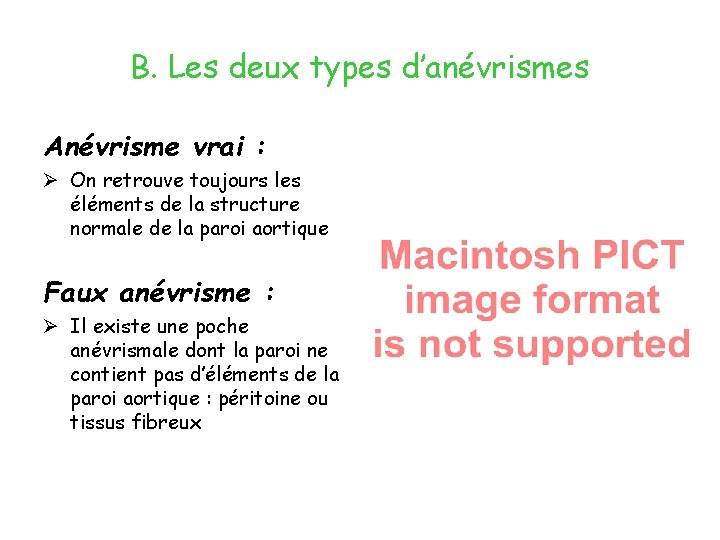 B. Les deux types d’anévrismes Anévrisme vrai : Ø On retrouve toujours les éléments