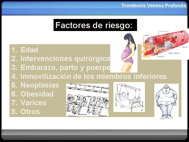 Trombosis Venosa Profunda Factores de riesgo: 1. 2. 3. 4. 5. 6. 7. 8.