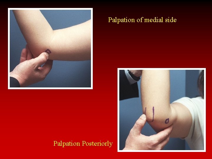 Palpation of medial side Palpation Posteriorly 