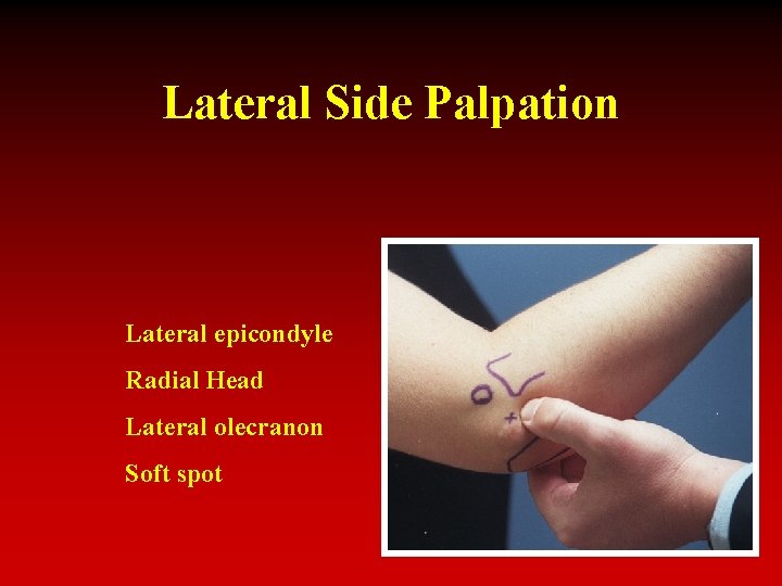 Lateral Side Palpation Lateral epicondyle Radial Head Lateral olecranon Soft spot 