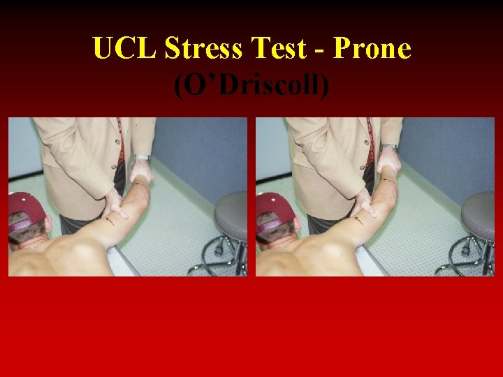 UCL Stress Test - Prone (O’Driscoll) 