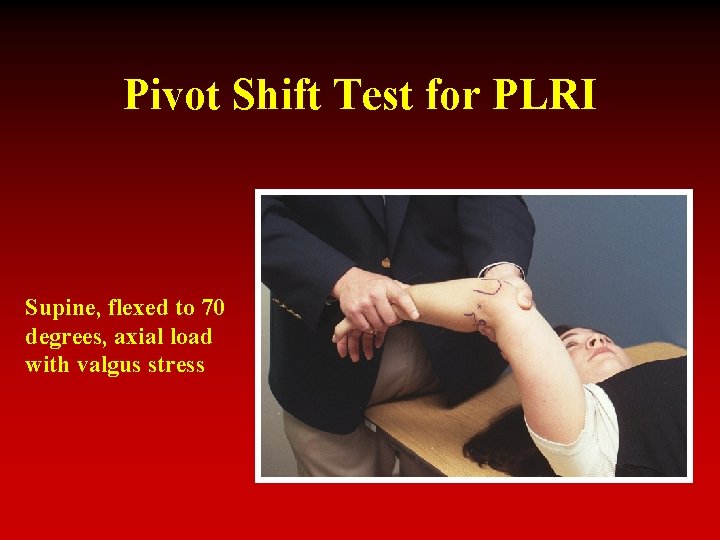 Pivot Shift Test for PLRI Supine, flexed to 70 degrees, axial load with valgus