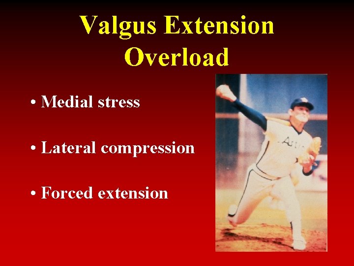 Valgus Extension Overload • Medial stress • Lateral compression • Forced extension 