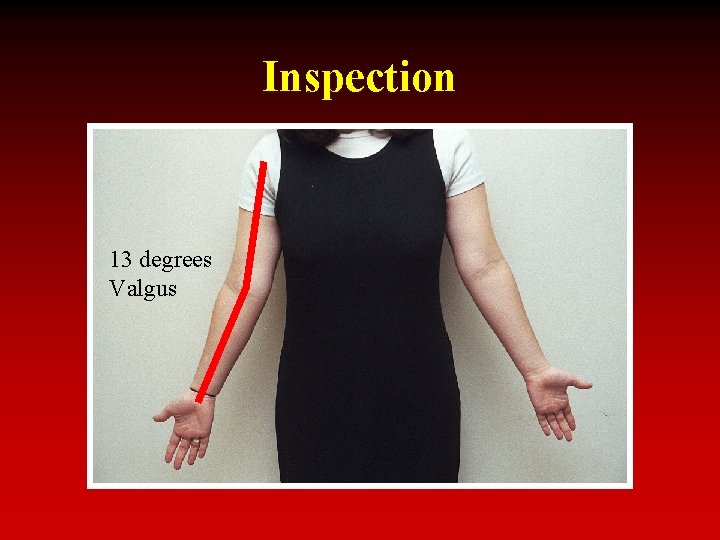 Inspection 13 degrees Valgus 