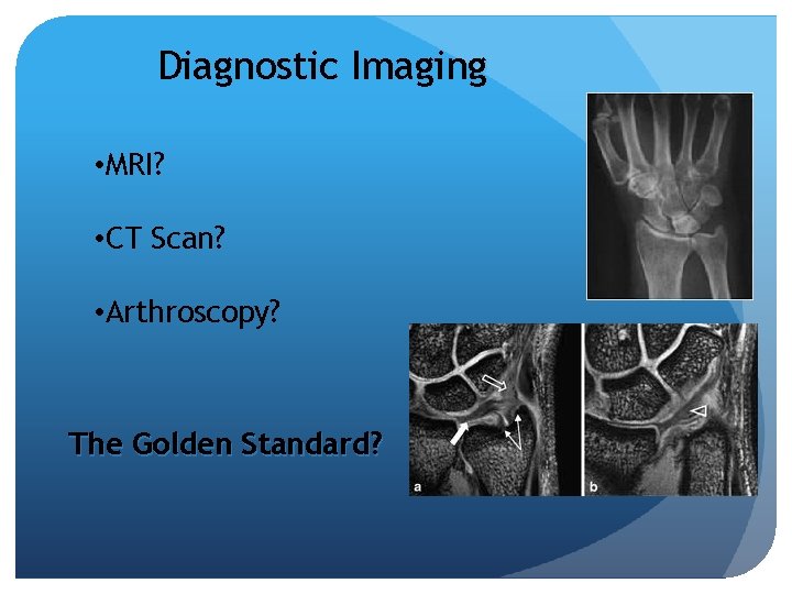 Diagnostic Imaging • MRI? • CT Scan? • Arthroscopy? The Golden Standard? 