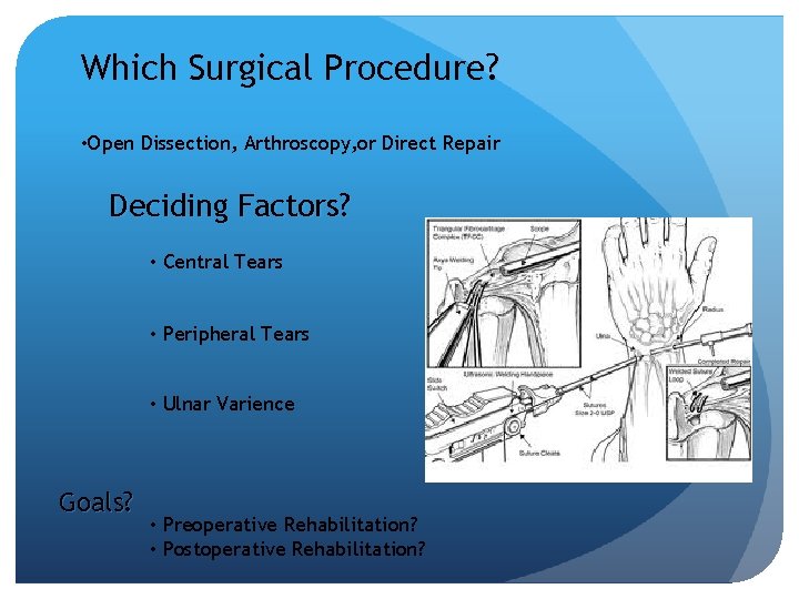 Which Surgical Procedure? • Open Dissection, Arthroscopy, or Direct Repair Deciding Factors? • Central