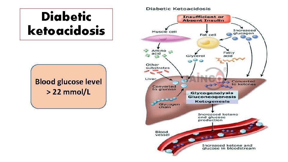 Diabetic ketoacidosis Blood glucose level > 22 mmol/L 