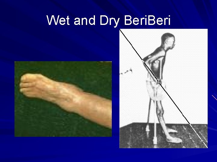 Wet and Dry Beri 