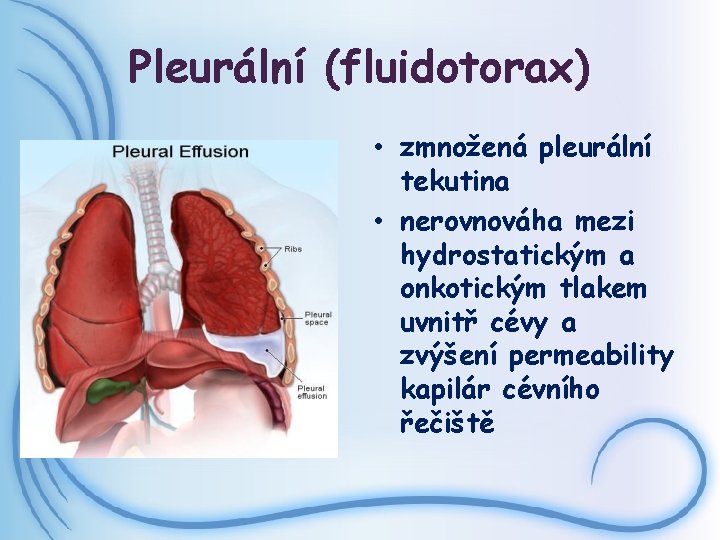 Pleurální (fluidotorax) • zmnožená pleurální tekutina • nerovnováha mezi hydrostatickým a onkotickým tlakem uvnitř