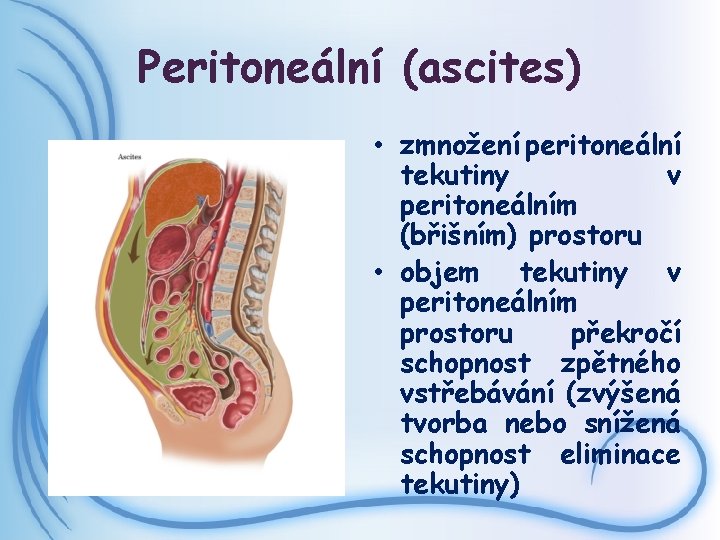 Peritoneální (ascites) • zmnožení peritoneální tekutiny v peritoneálním (břišním) prostoru • objem tekutiny v