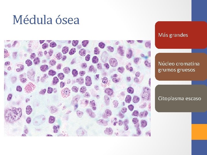 Médula ósea Más grandes Núcleo cromatina grumos gruesos Citoplasma escaso 