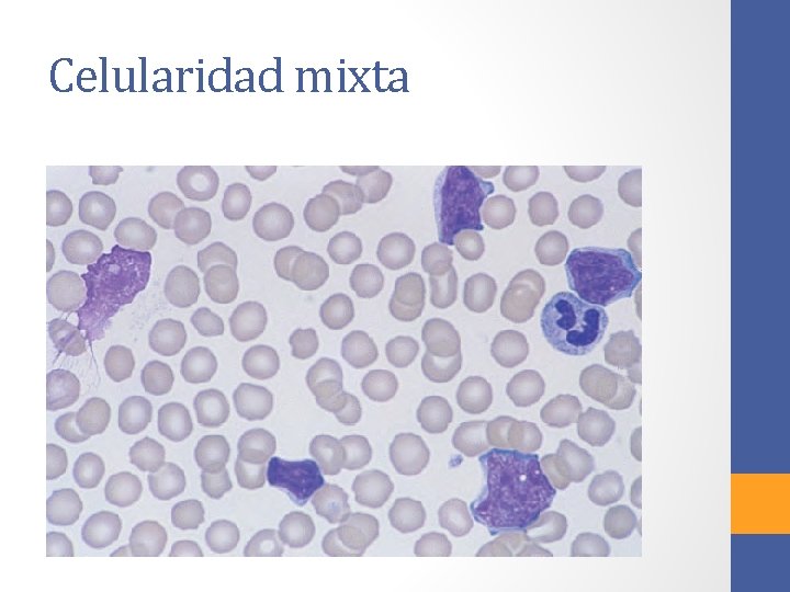 Celularidad mixta 