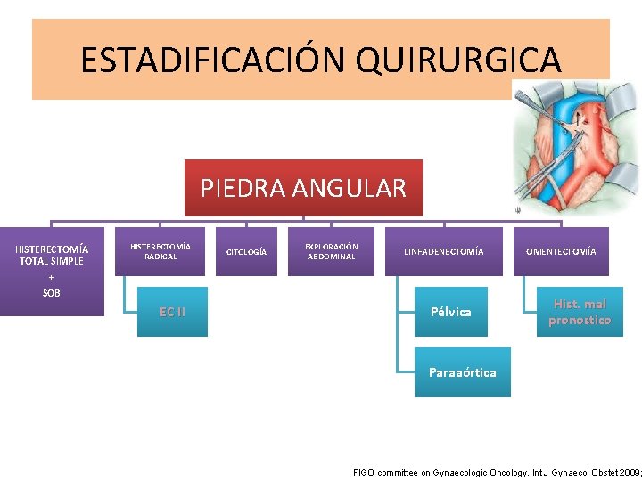 ESTADIFICACIÓN QUIRURGICA PIEDRA ANGULAR HISTERECTOMÍA TOTAL SIMPLE + HISTERECTOMÍA RADICAL CITOLOGÍA EXPLORACIÓN ABDOMINAL LINFADENECTOMÍA