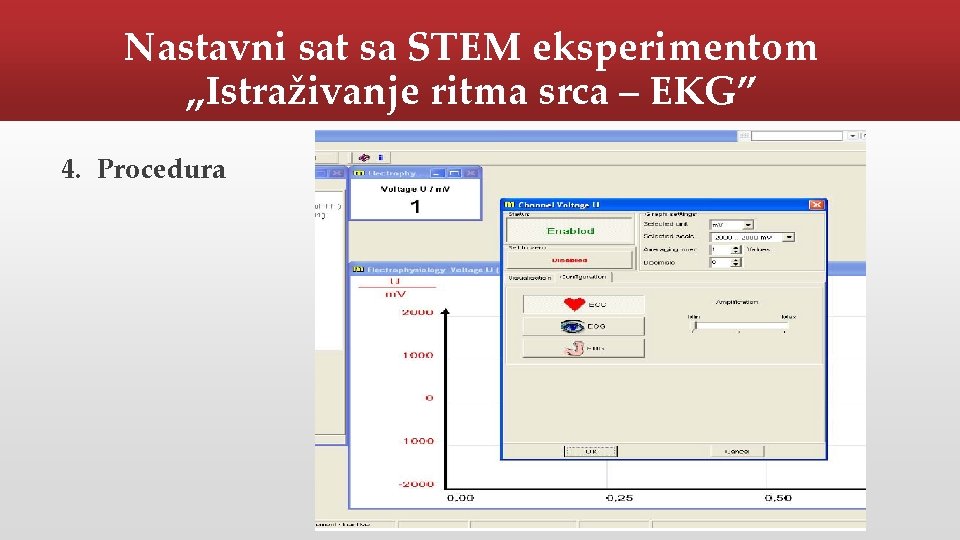 Nastavni sat sa STEM eksperimentom „Istraživanje ritma srca – EKG” 4. Procedura 