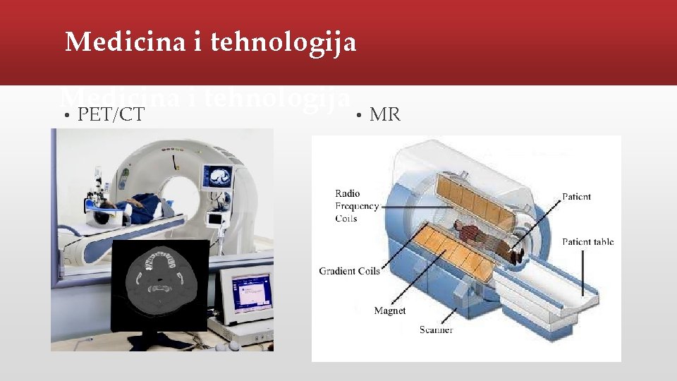 Medicina i tehnologija • PET/CT • MR 