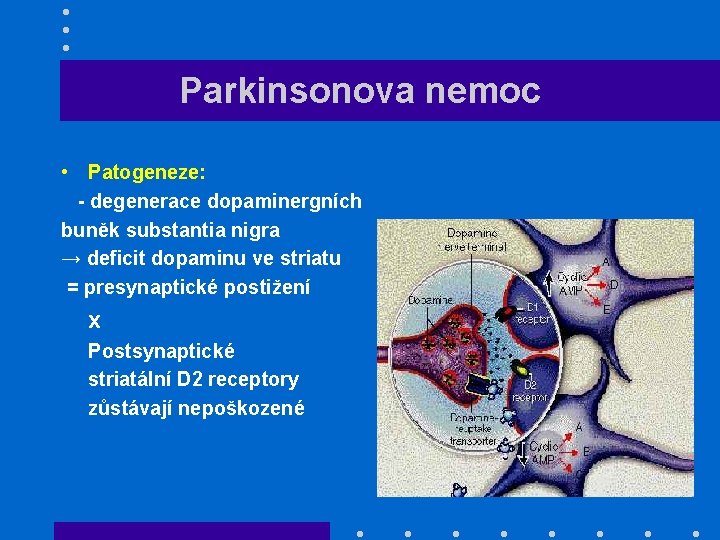 Parkinsonova nemoc • Patogeneze: - degenerace dopaminergních buněk substantia nigra → deficit dopaminu ve