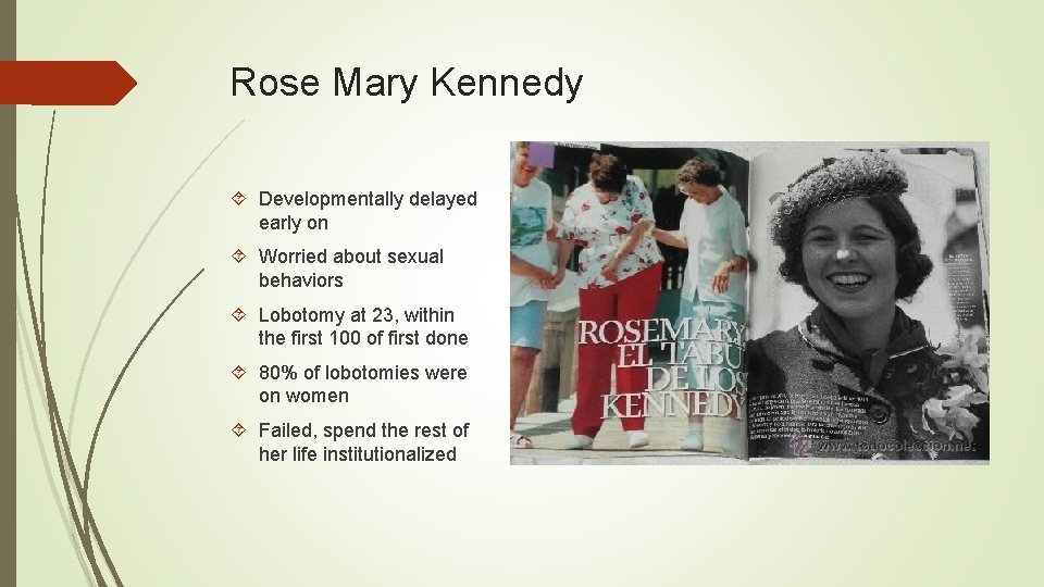 Rose Mary Kennedy Developmentally delayed early on Worried about sexual behaviors Lobotomy at 23,