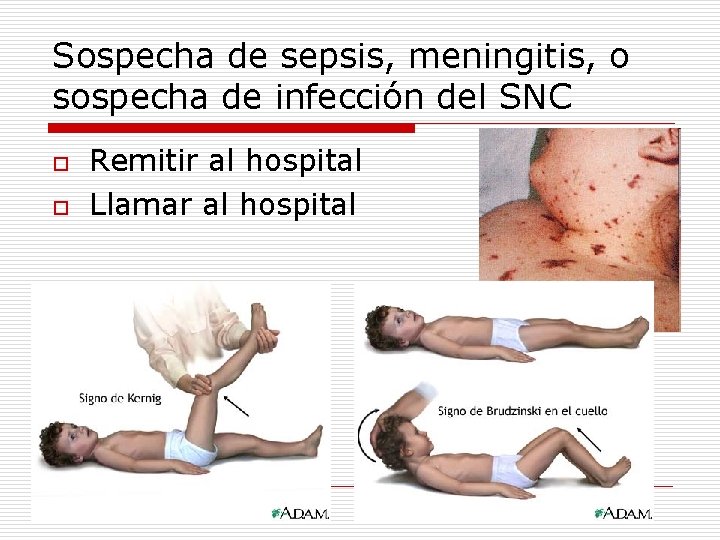 Sospecha de sepsis, meningitis, o sospecha de infección del SNC o o Remitir al