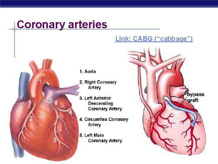 Coronary arteries Link: CABG (“cabbage”) 