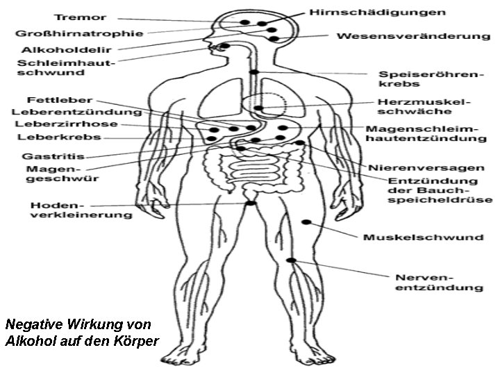 Negative Wirkung von Alkohol auf den Körper 