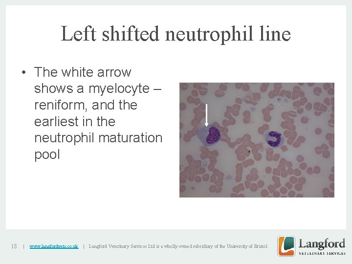 Left shifted neutrophil line • The white arrow shows a myelocyte – reniform, and