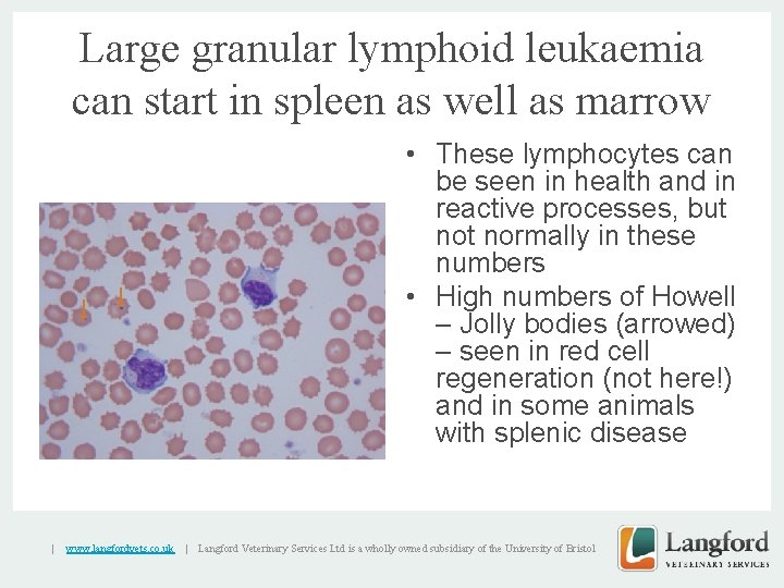 Large granular lymphoid leukaemia can start in spleen as well as marrow v |