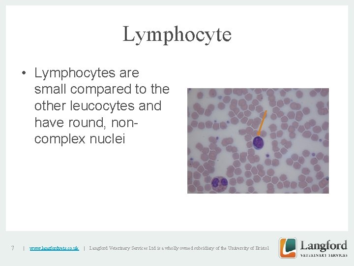 Lymphocyte • Lymphocytes are small compared to the other leucocytes and have round, noncomplex