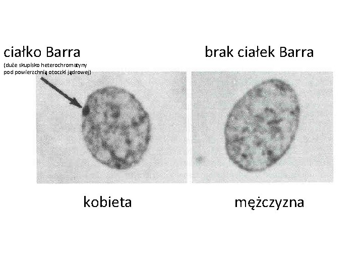 ciałko Barra (duże skupisko heterochromatyny pod powierzchnią otoczki jądrowej) kobieta brak ciałek Barra mężczyzna