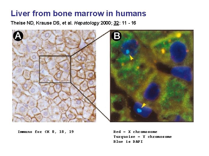 Liver from bone marrow in humans Theise ND, Krause DS, et al. Hepatology 2000;