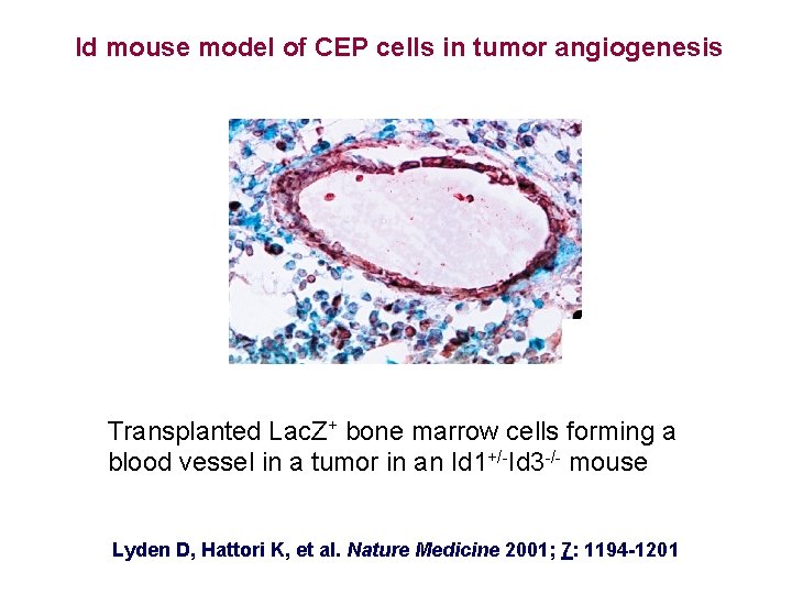 Id mouse model of CEP cells in tumor angiogenesis Transplanted Lac. Z+ bone marrow