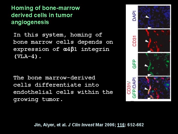 Homing of bone-marrow derived cells in tumor angiogenesis In this system, homing of bone