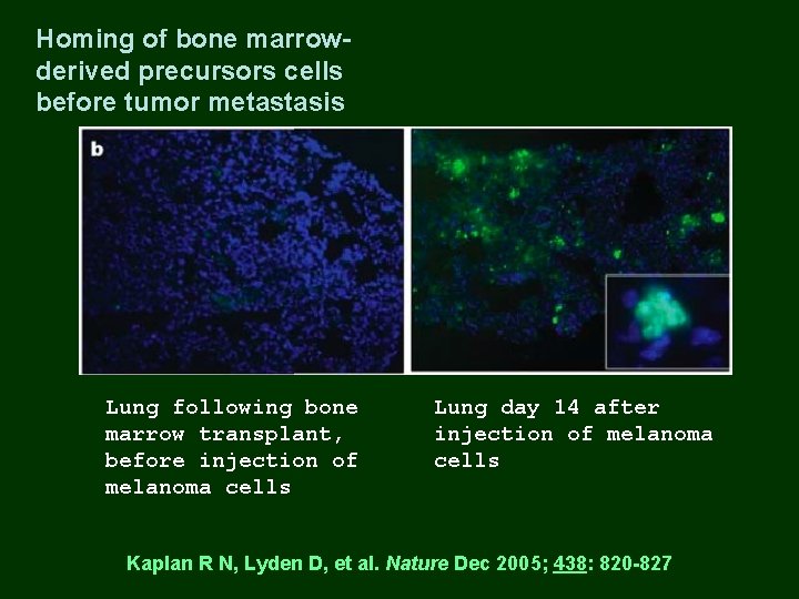 Homing of bone marrowderived precursors cells before tumor metastasis Lung following bone marrow transplant,