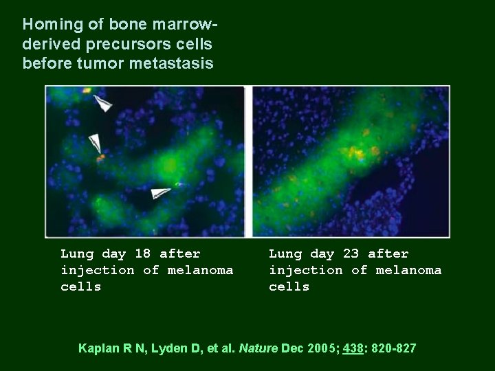 Homing of bone marrowderived precursors cells before tumor metastasis Lung day 18 after injection