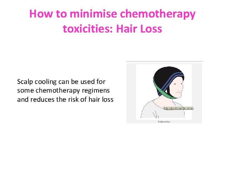 How to minimise chemotherapy toxicities: Hair Loss Scalp cooling can be used for some
