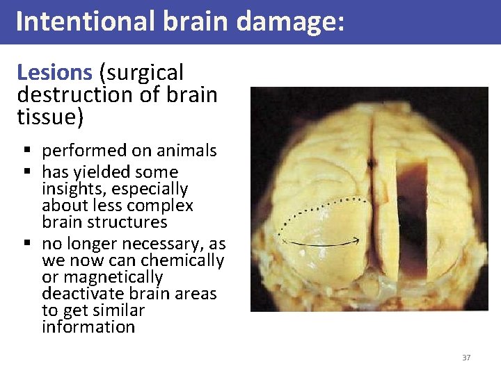 Intentional brain damage: Lesions (surgical destruction of brain tissue) § performed on animals §