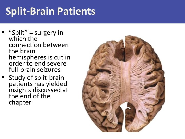 Split-Brain Patients § “Split” = surgery in which the connection between the brain hemispheres