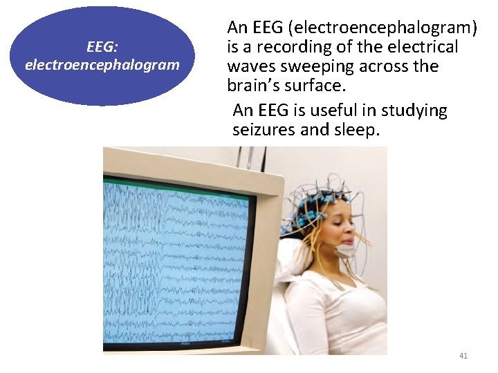 EEG: electroencephalogram An EEG (electroencephalogram) is a recording of the electrical waves sweeping across