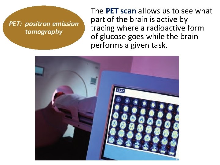 PET: positron emission tomography The PET scan allows us to see what part of