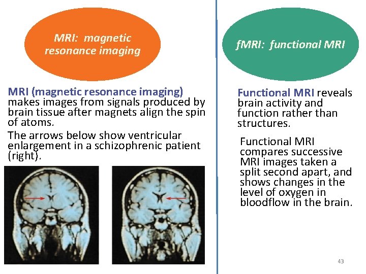 MRI: magnetic resonance imaging MRI (magnetic resonance imaging) makes images from signals produced by