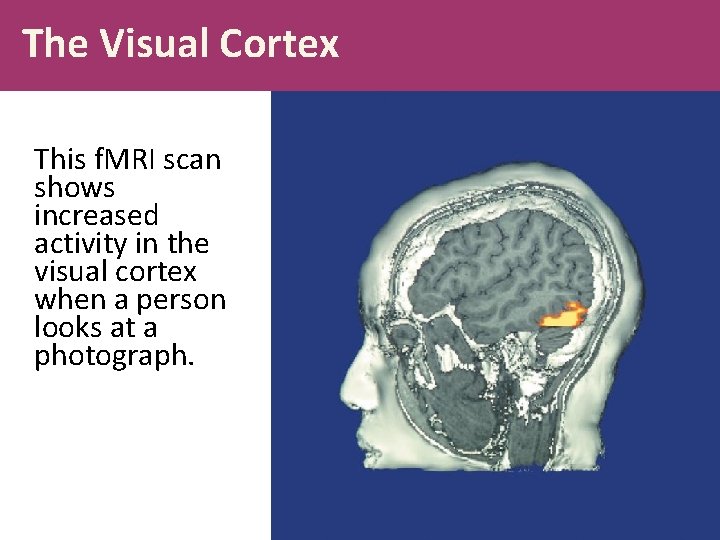 The Visual Cortex This f. MRI scan shows increased activity in the visual cortex