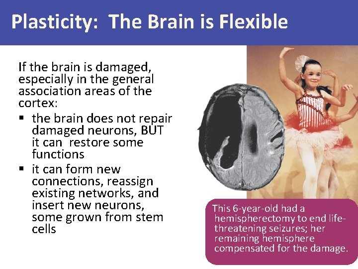 Plasticity: The Brain is Flexible If the brain is damaged, especially in the general