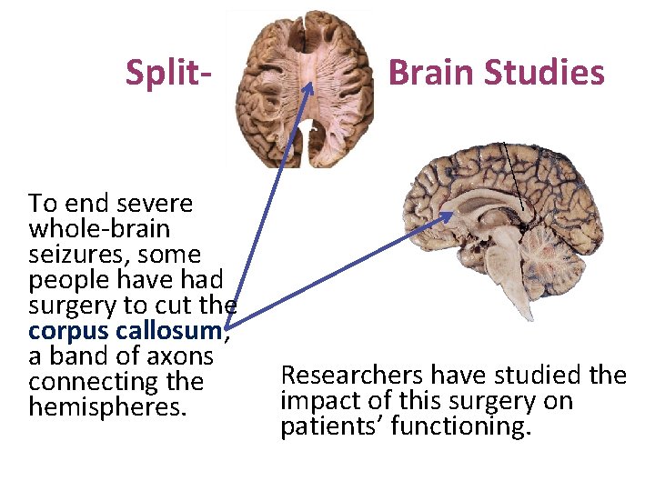 Split. To end severe whole-brain seizures, some people have had surgery to cut the