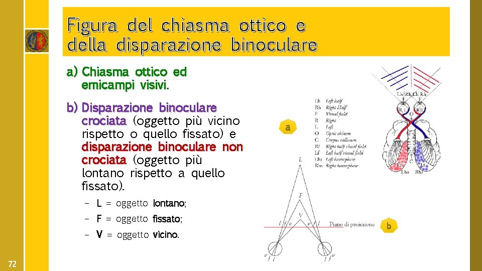 Figura del chiasma ottico e della disparazione binoculare a) Chiasma ottico ed emicampi visivi.