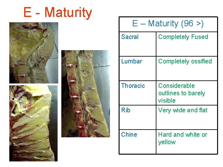 E - Maturity E – Maturity (96 >) Sacral Completely Fused Lumbar Completely ossified