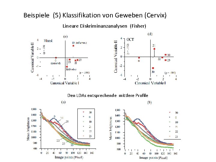 Beispiele (5) Klassifikation von Geweben (Cervix) Lineare Diskriminanzanalysen (Fisher) Den LDAs entsprechende mittlere Profile