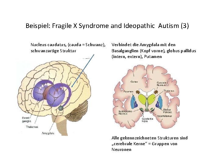Beispiel: Fragile X Syndrome and Ideopathic Autism (3) Nucleus caudatus, (cauda = Schwanz), schwanzartige