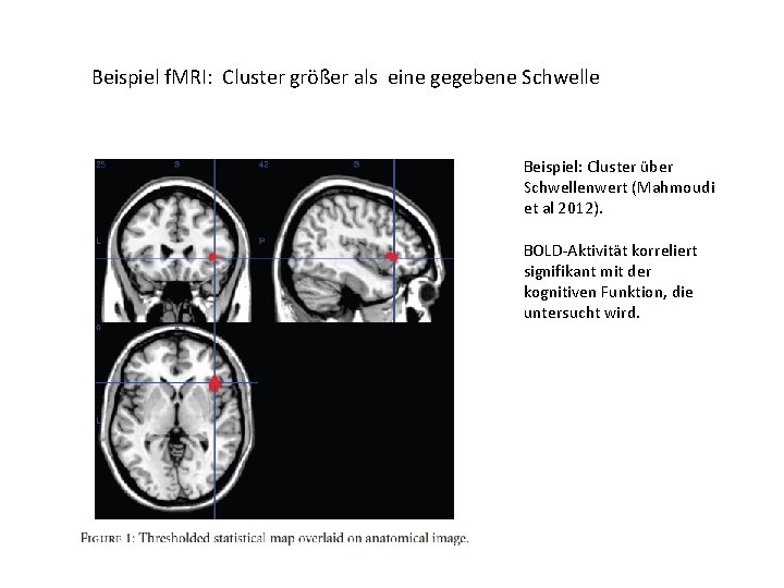 Beispiel f. MRI: Cluster größer als eine gegebene Schwelle Beispiel: Cluster über Schwellenwert (Mahmoudi