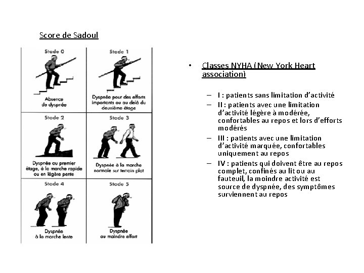 Score de Sadoul • Classes NYHA (New York Heart association) – I : patients