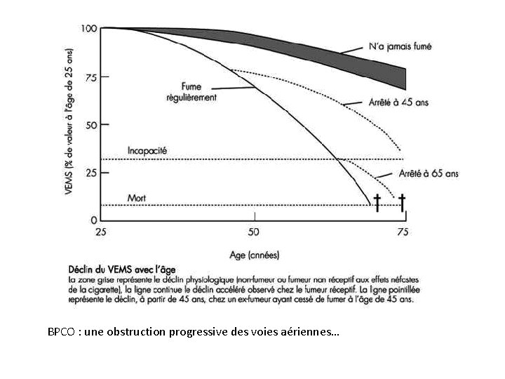 BPCO : une obstruction progressive des voies aériennes… 