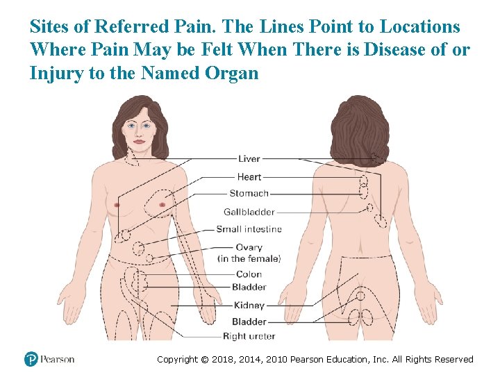 Sites of Referred Pain. The Lines Point to Locations Where Pain May be Felt